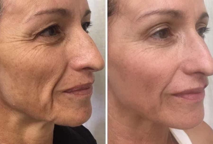 Before / After